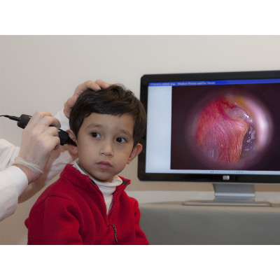 Цифровой отоскоп Firefly DE500 Цифровой отоскоп Firefly DE500