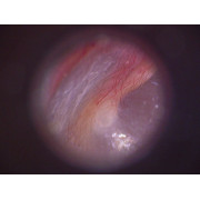 Цифровой отоскоп Firefly DE500