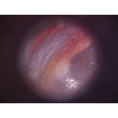 Цифровой отоскоп Firefly DE500 Цифровой отоскоп Firefly DE500