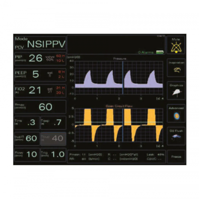 Неонатальный аппарат искусственной вентиляции легких Giulia Неонатальный аппарат искусственной вентиляции легких Giulia